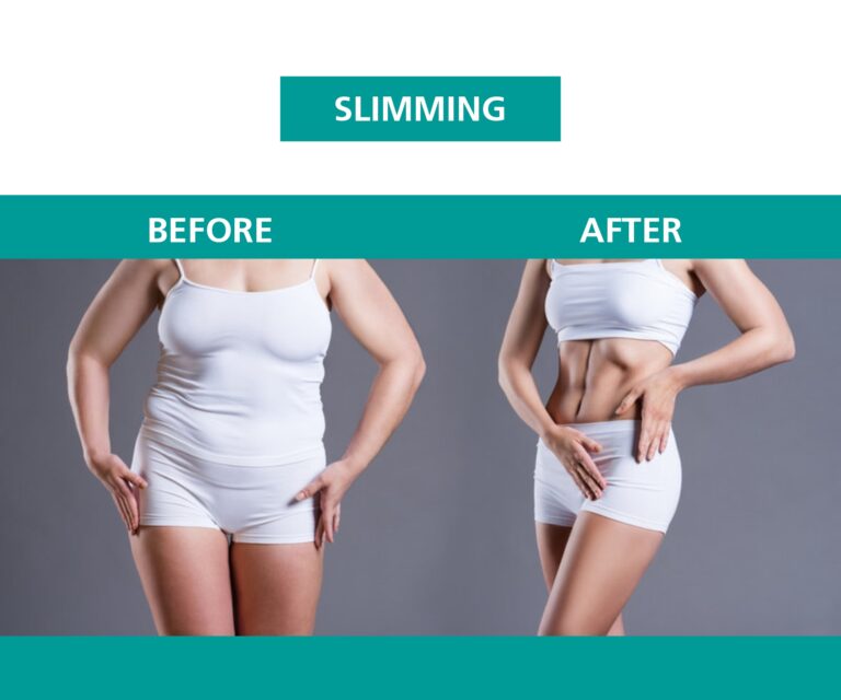 Slimming before after