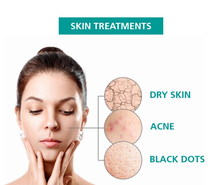 Skin treatments